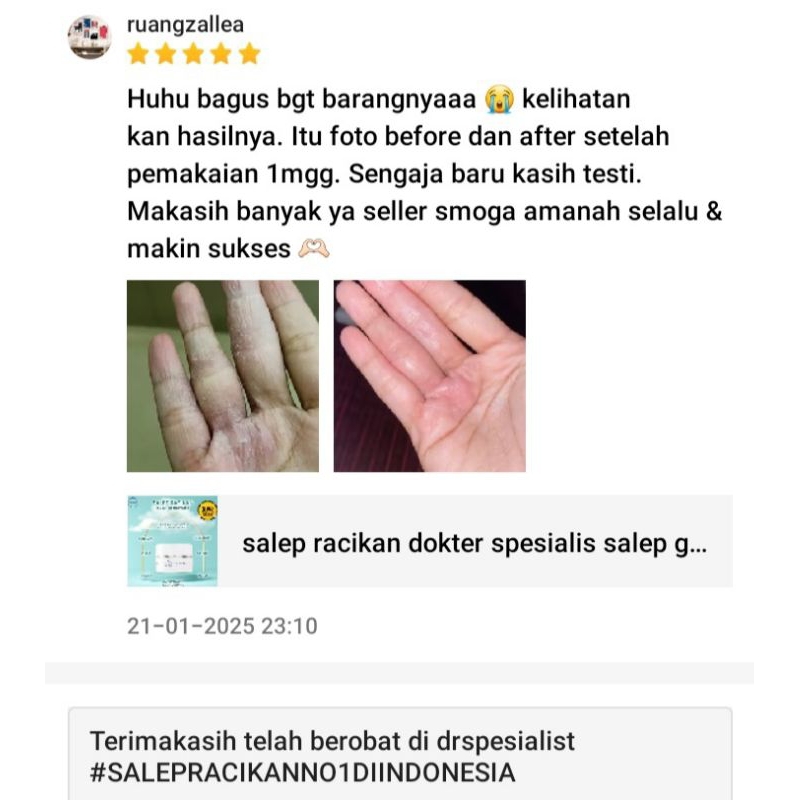 Salep Psoriasis Eksim Jamur Dermatitis Racikan Dr Spesialis Kemasan Ekonomis