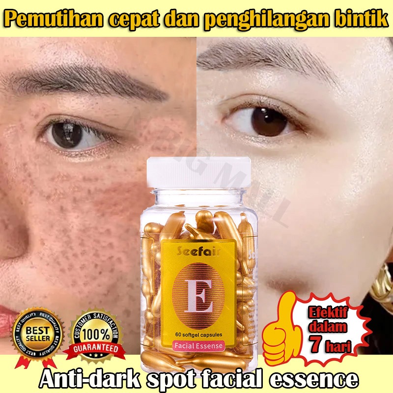 Serum Flek Hitam Membandel Serum wajah penghilang flek hitam di wajah Serum vitamin e Facial Essence