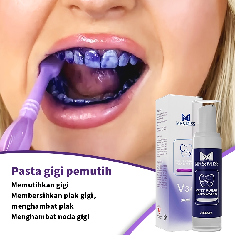 Pasta gigi pemutih Perontok karang gigi Perontok karang gigi paling ampuh 30ml Pembersih karang gigi