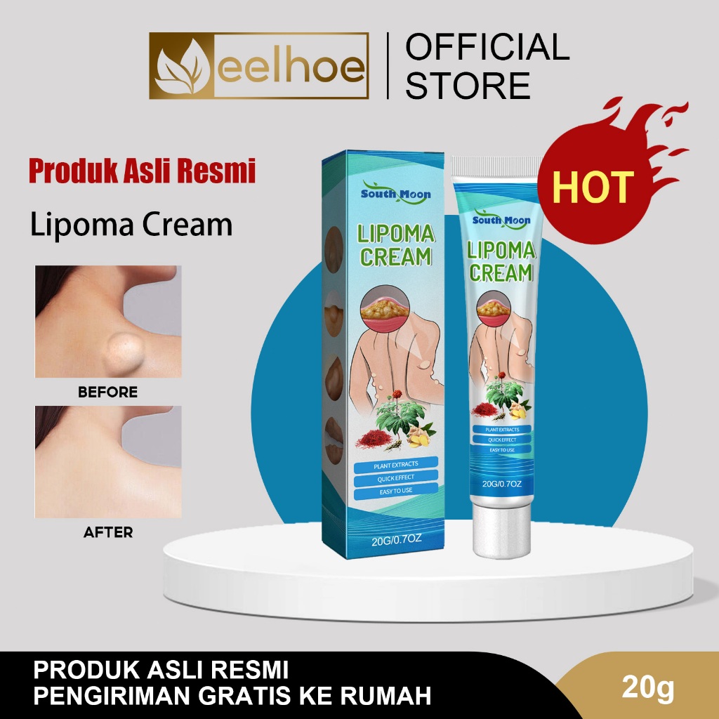 South Moon Lipoma Cream Original 20g Obat Benjolan Di Ketiak / Obat Lipoma / Salep Penghilang Benjol