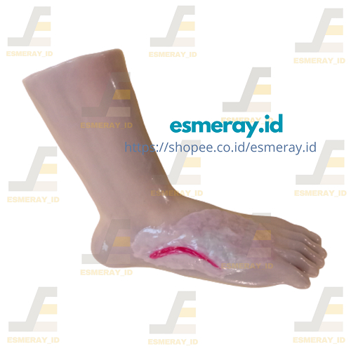Manikin/Manekin Simulator Kaki Luka Epithelisasi-Praktek Edukasi Pengenalan Jenis Luka Model Kaki