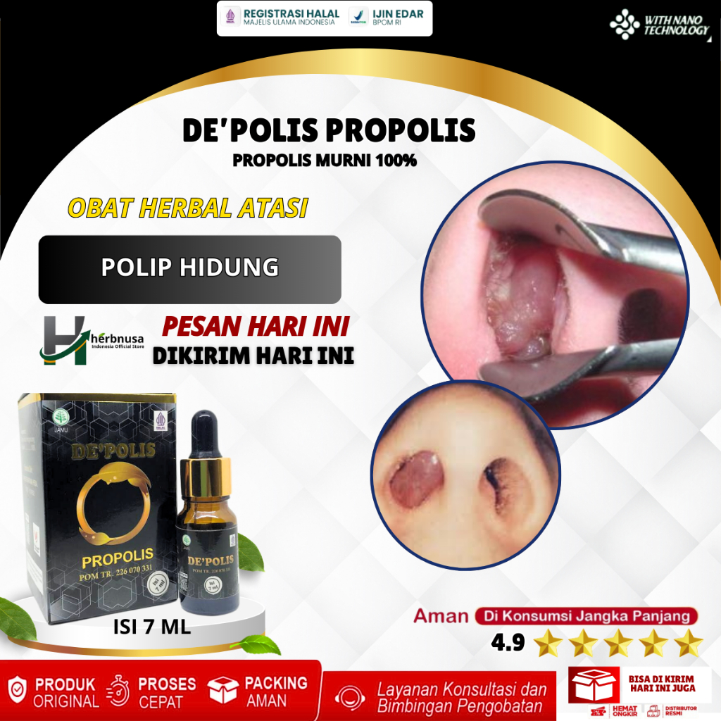 Obat Polip Hidung, Obat Polip Hidung Semprot, Polip Hidung Untuk Dewasa & Anak Anak, Obat Sinusitis 