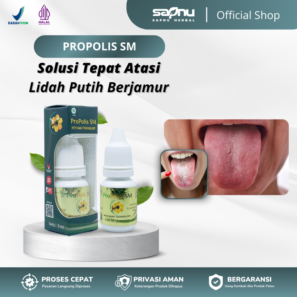 Obat Lidah Putih Lidah Pecah Pecah Lidah Putih Berjamur Lidah Mati Rasa Lidah Terasa Pahit Lidah Sar