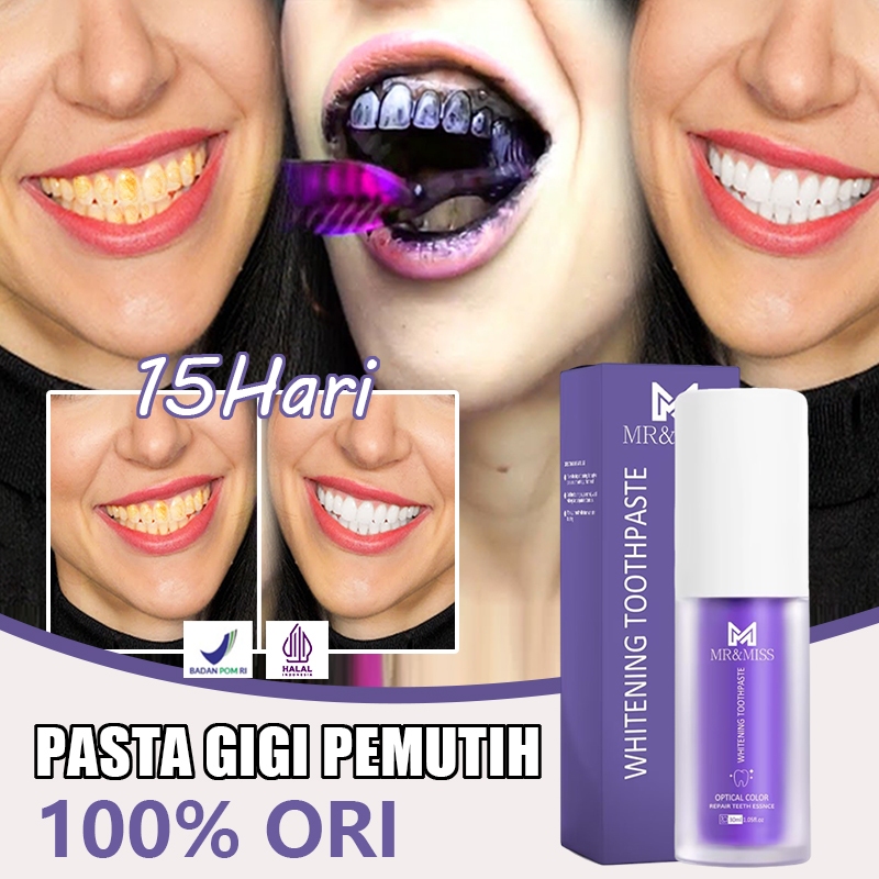 Pasta gigi pemutih Perontok karang gigi Perontok karang gigi paling ampuh 30ml Pemutih gigi