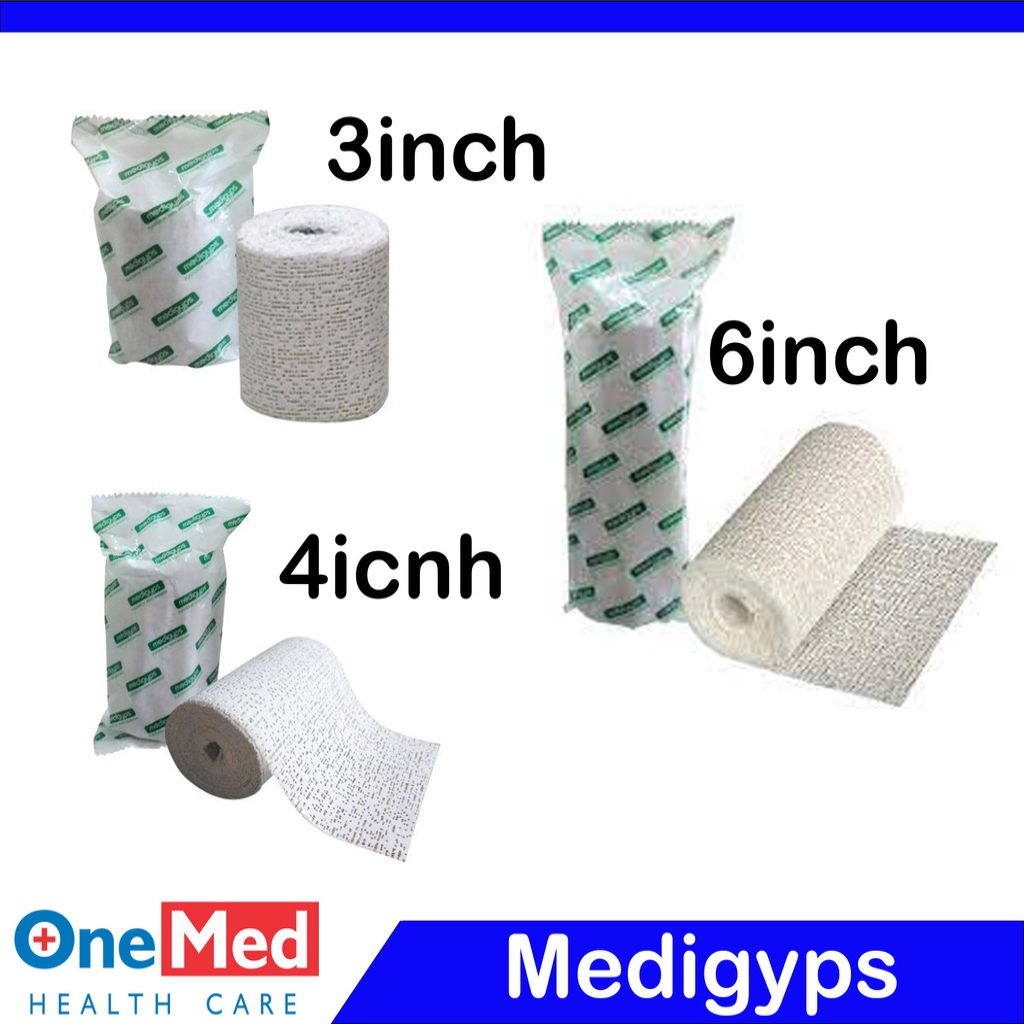 Medigyps Onemed/Medigyps Orthopedi Gips Patah Tulang