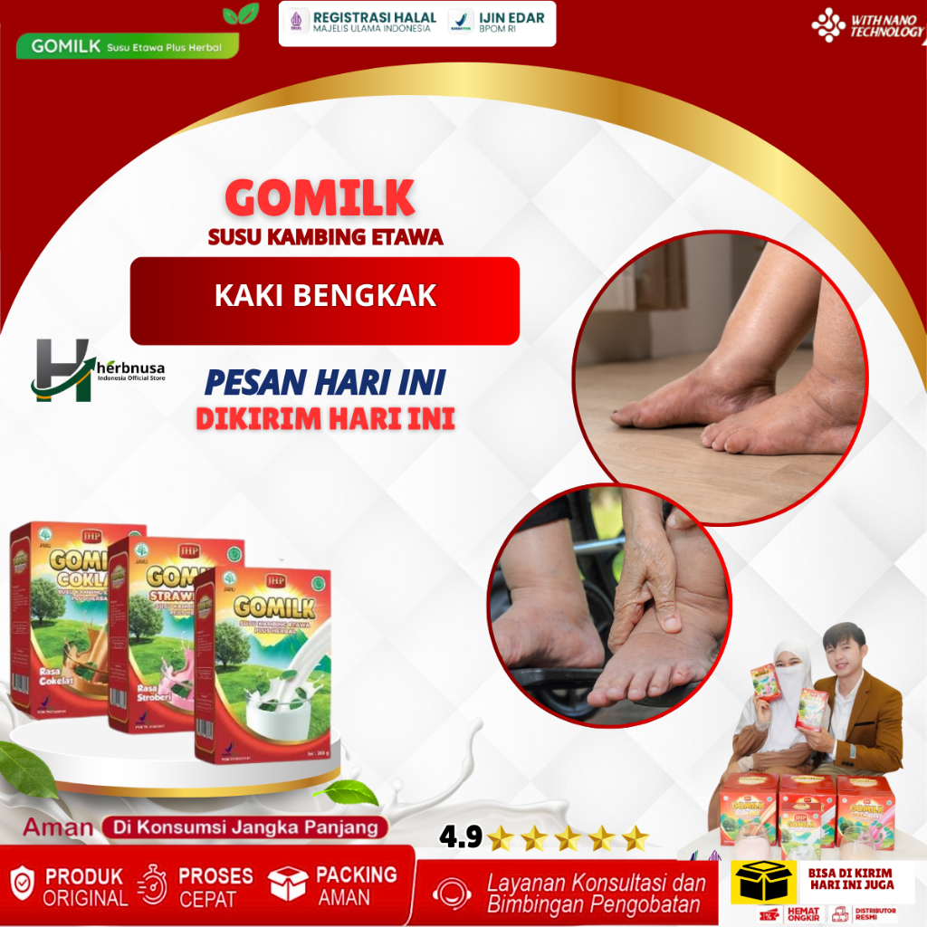 Obat Kaki Bengkak Karena Jatuh Kaki Keseleo Nyeri Kaki Diabetes Saraf Penyumbatan Darah Ginjal Jantu