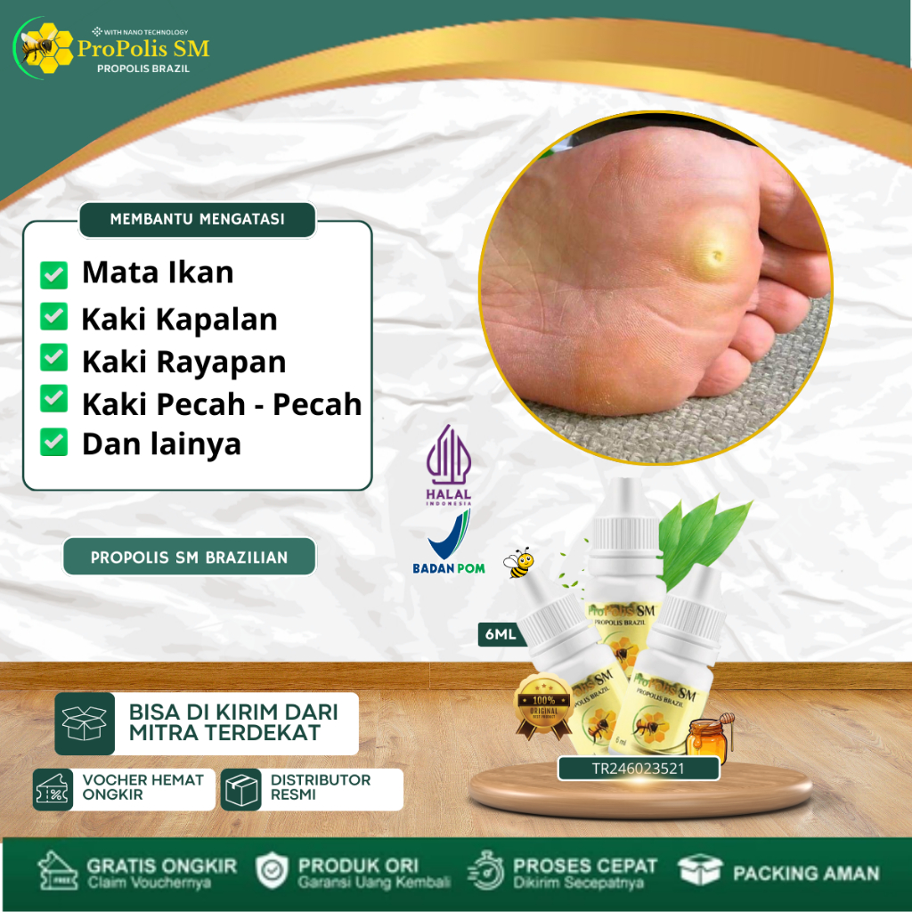 Mata Ikan Di Telapak Kaki, Obat kutil kaki, Kutil Mata Ikan, Penghilang Mata Ikan, Obat Perontok Mat