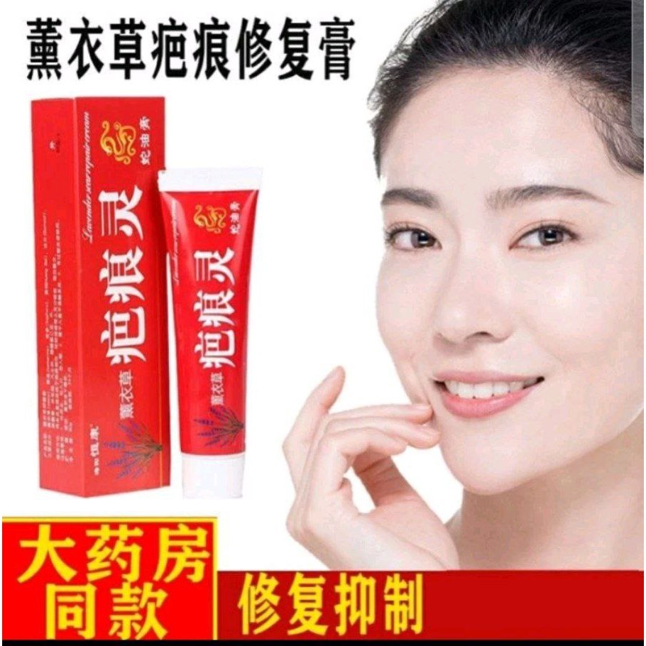 Cream Penghilang Bekas Luka | Keloid Stretcmarch | Salep Bahenling