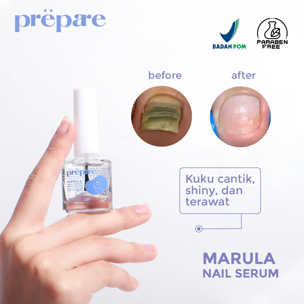 PREPARE Vitamin Kuku Rusak Obat Cantengan Kuku Kaki dan Tangan Perawatan Kuku Menicure Pedicure