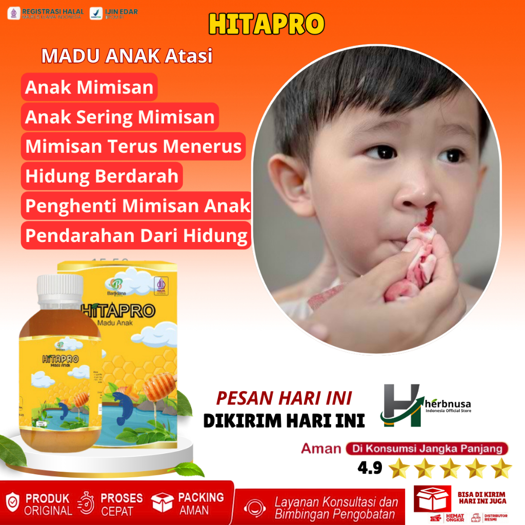 Obat Untuk Anak Mimisan, Obat Anak Sering Mimisan, Obat Mimisan Terus Menerus, Pendarahan Dari Hidun