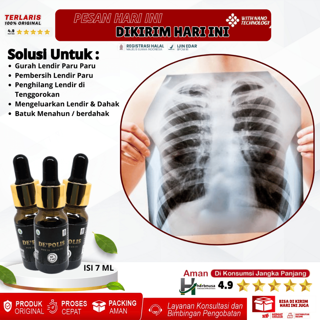 Obat Gurah Lendir Paru Paru, Obat Pembersih Lendir Paru Paru, Obat Penghilang Lendir di Tenggorokan,