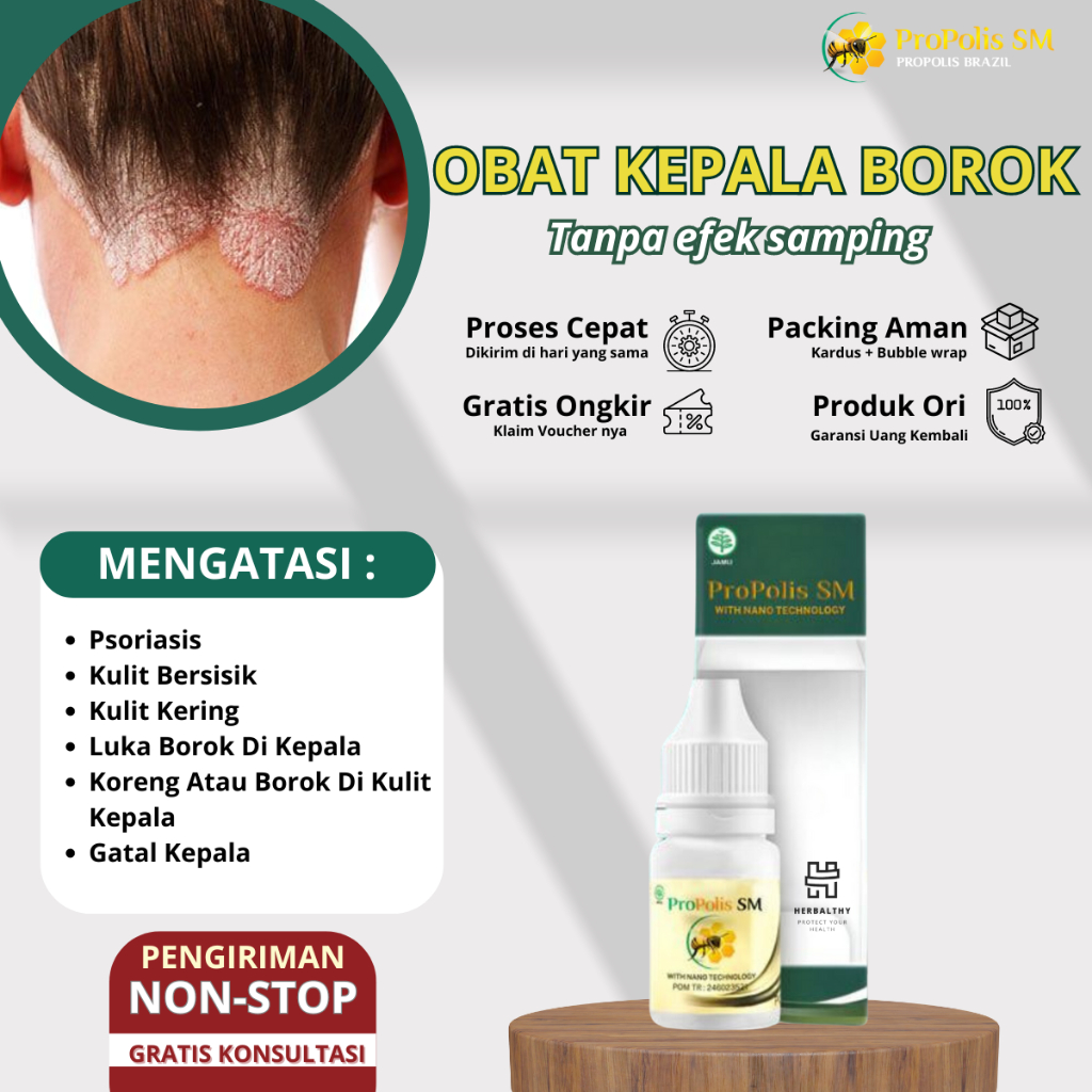 Obat Koreng Di Kepala Obat Borok di Kulit Kepala Psoriasis Kulit Bersisik Kering Luka Borok Koreng D