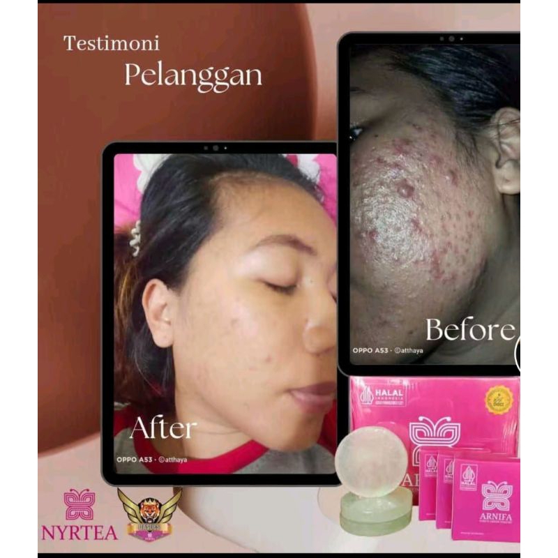 Sabun Arnifa by Nyrtea || Sabun Glowing