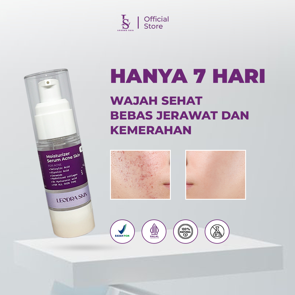 LEODRA SKIN Moisturizer Menghilangkan Bekas Jerawat Ampuh , Jerawat Merah, Jerawat Hitam