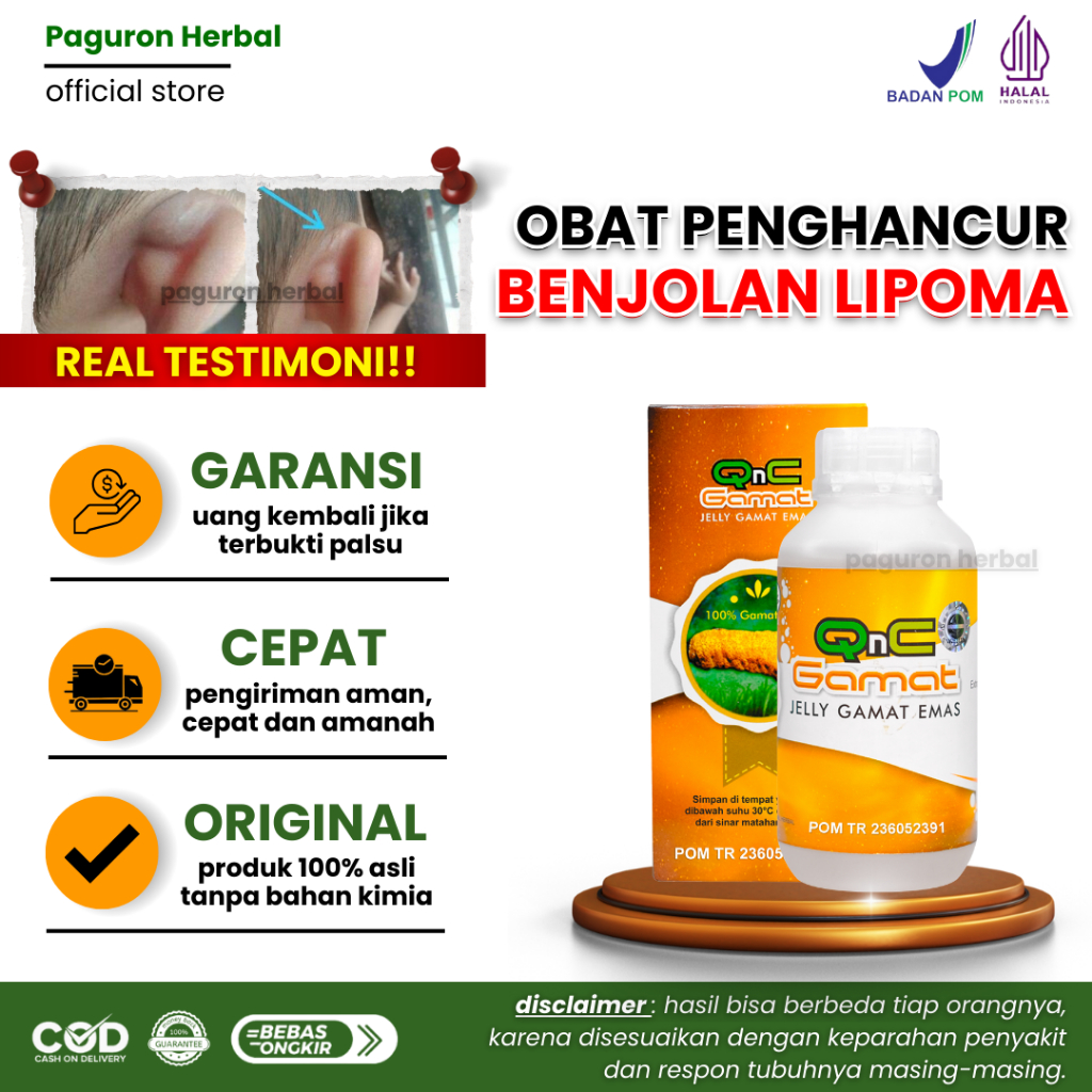 Obat Benjolan Lipoma, Obat Penghancur Lipoma, Benjolan Uci Uci | QNC JELLY GAMAT