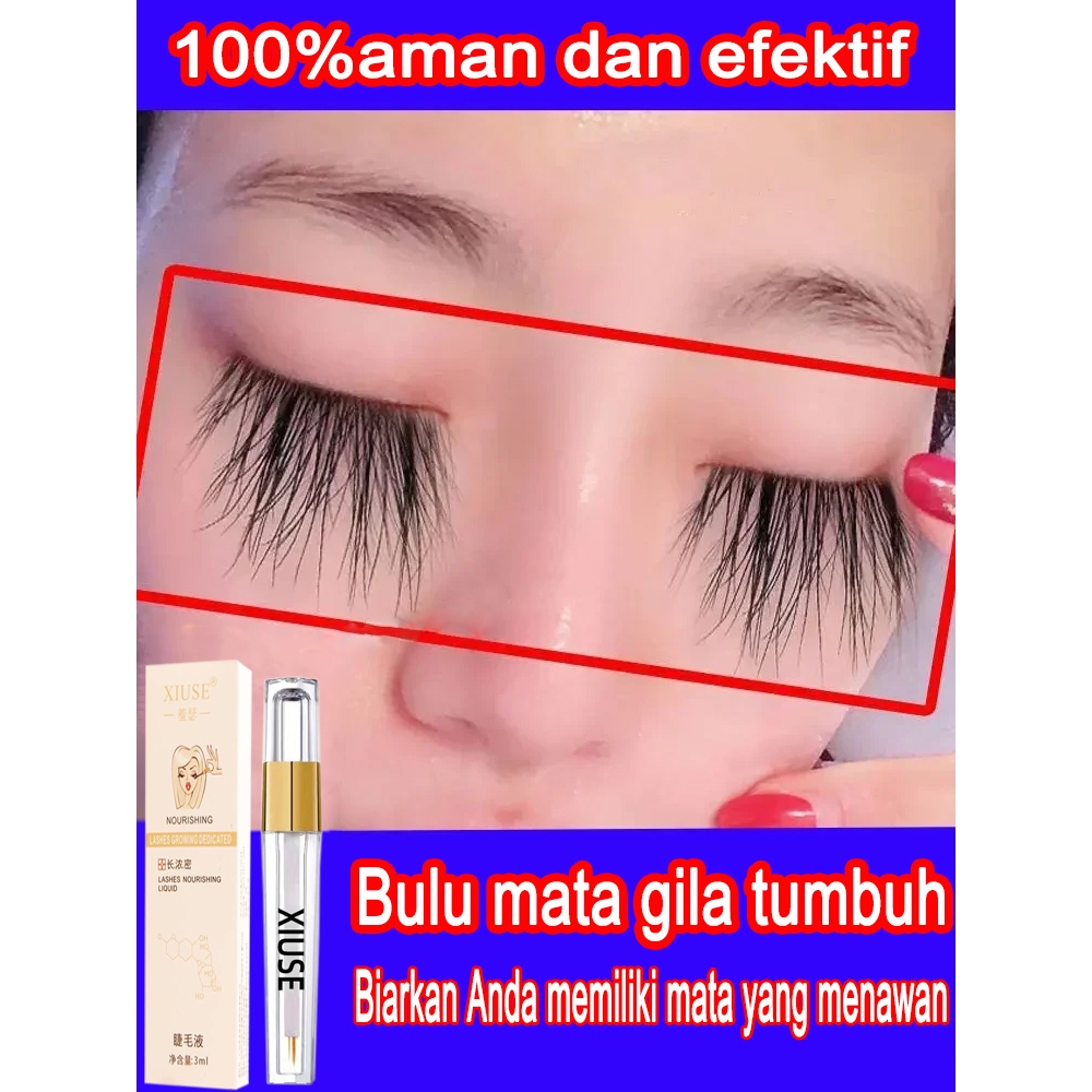 serum bulu mata / penebal alis dan bulu mata / serum bulu mata cepat panjang /serum bulu mata dan al
