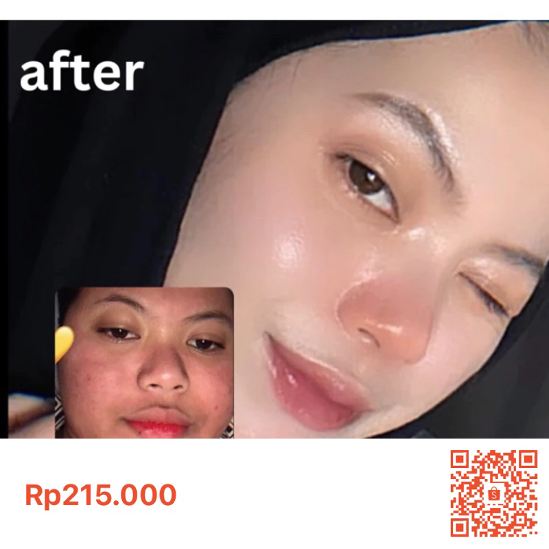 Skincare ori sepaket by Elisa ayu skincare