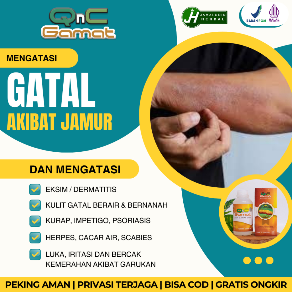Obat Oles Anti Jamur - Salep Gatal Gatel Herbal Penghilang Jamur Kulit Di Kepala / Tangan / Kaki