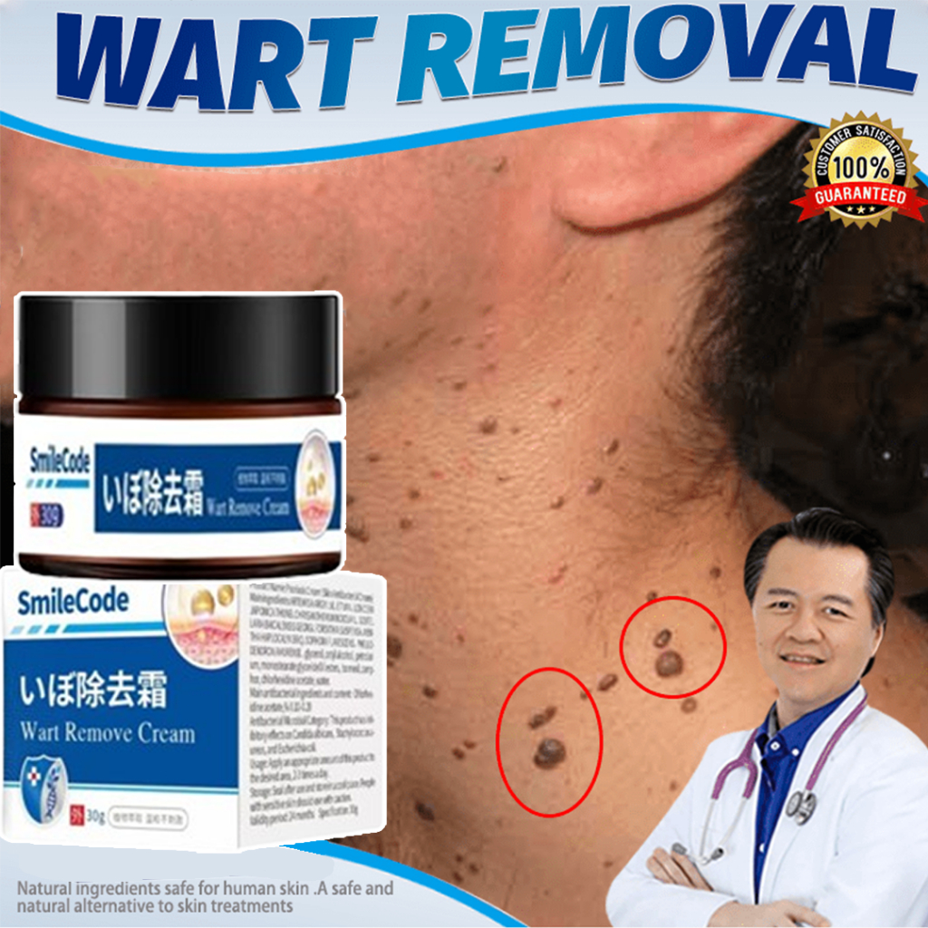 Cream penghilang kutil 30g obat kutil salep kutil paling ampuh penghilang kutil dan tahi lalat pengh