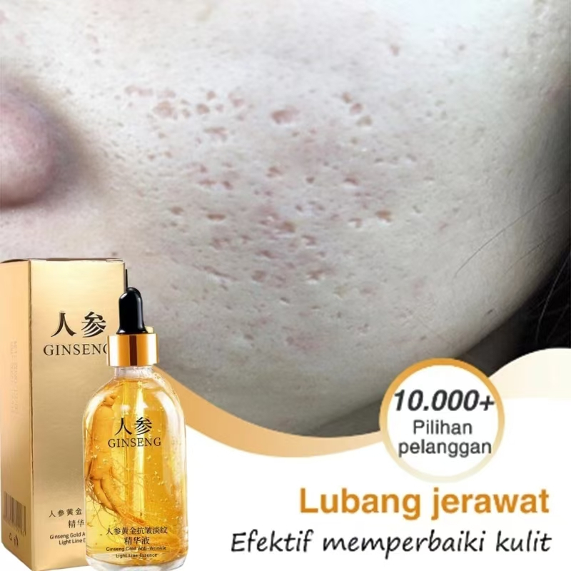 Serum penghilang bekas jerawat menghilangkan pori-pori Salep jerawat dan bekas jerawat