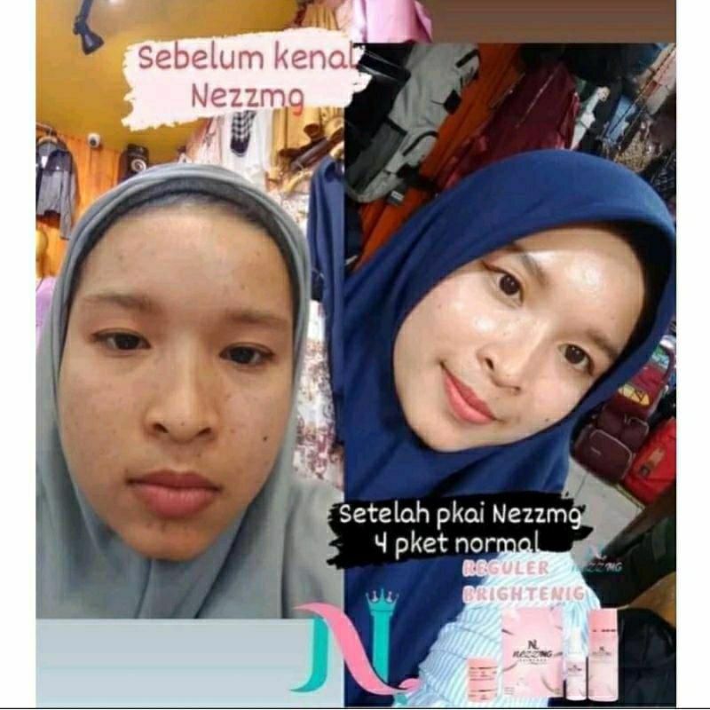 Nezzmg Skincare BPOM