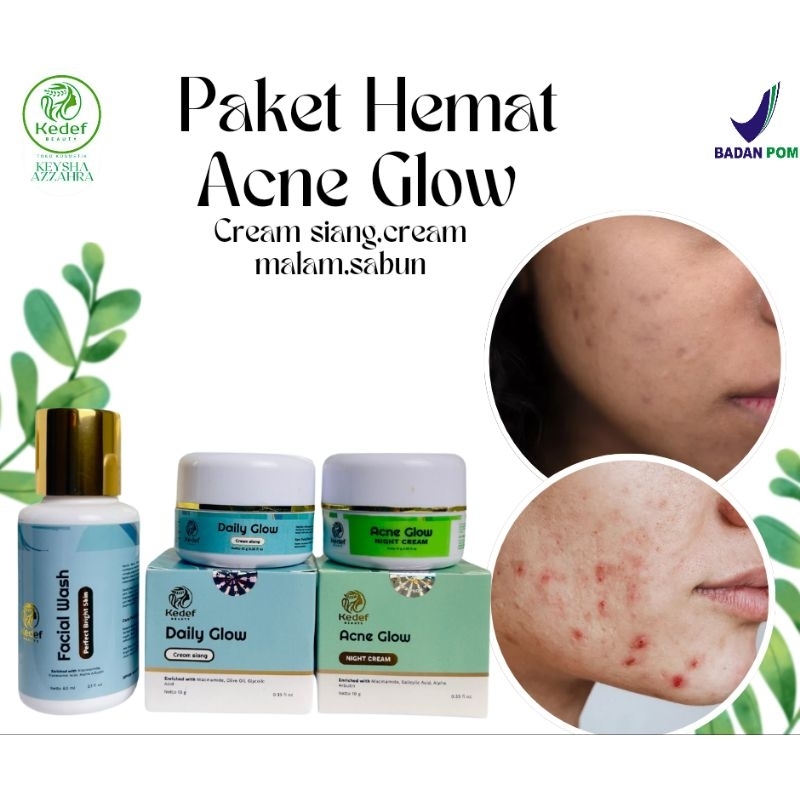 CREAM WAJAH ASLI FARMASI ISI 3,WHITENING BOOSTER,WHITENING GLOW,GLOW FLEK,ACNE GLOW