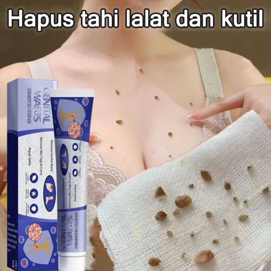 Wart remover obat kutil ori Obat Kutil paling ampuh Obat Kutil Kelamin Wart Remover Skin Tag Remover