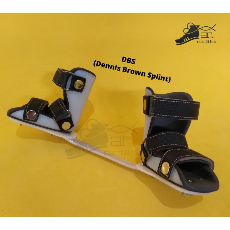 Sepatu Kaki CTEV / Club Foot / Pengkor / Bengkok / Jinjit , Dennis Brown Splint / DBS bayi dan anak