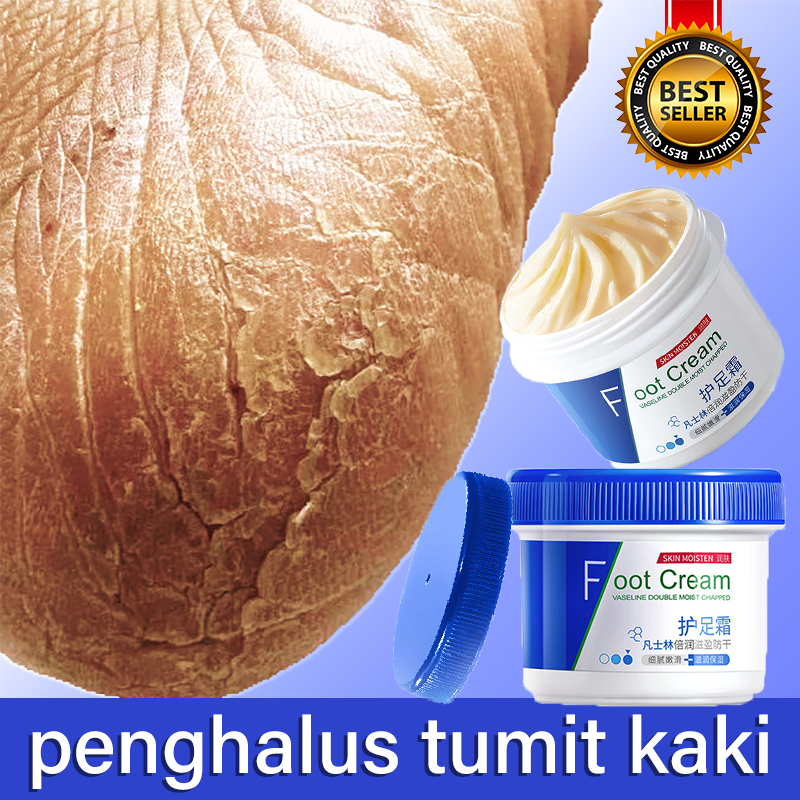 krim kaki pecah dan kering alat penghalus tumit kaki pelembab kaki pecah dan kering kaki kapalan dan