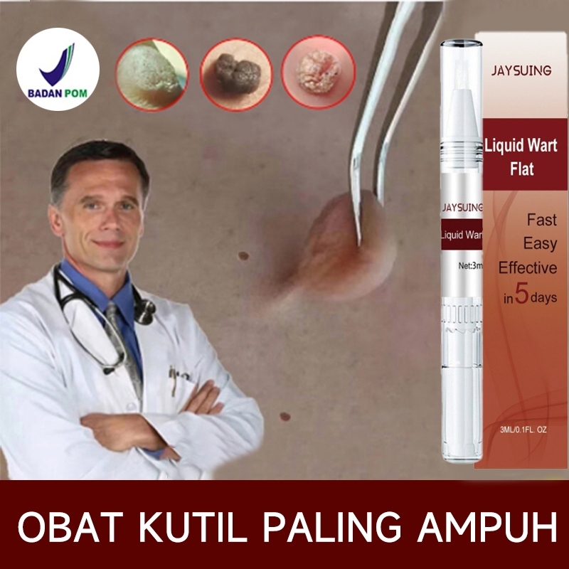 Penghilang Kutil Dan Tahi Lalat Obat Penghilang Kutil Di Wajah Papiloma Wajah Kutil Leher Penghilang