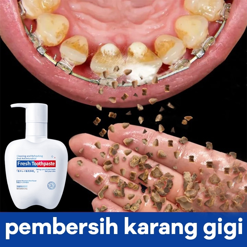 Pembersih karang gigi pemutih gigi odol pemutih gigi dan karang gigi pembersih gigi 200g alat pember