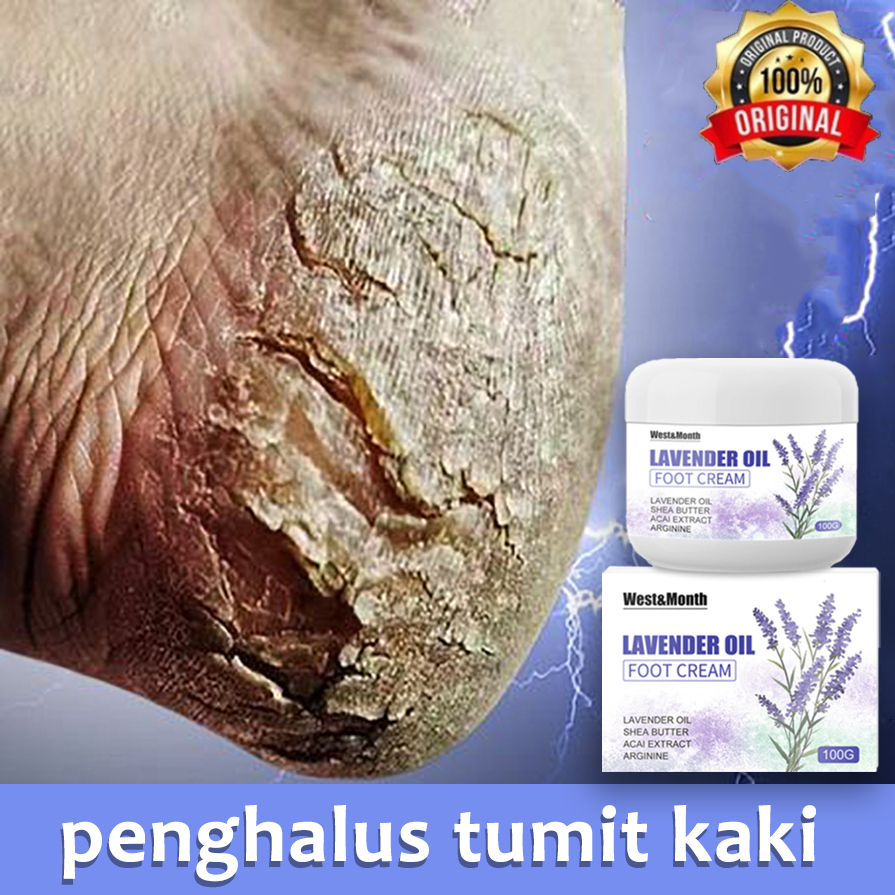 tumitku obat kaki pecah penghalus tumit kaki alat penghalus tumit kaki salep kaki pecah dan kering a