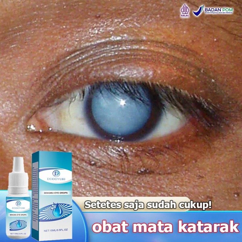 DODOYURI Obat mata katarak Obat mata minus Obat tetes mata Tetes mata 15ml Obat mata Obat katarak Ob