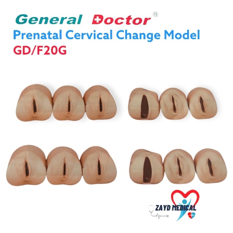 Phantom Manikin Prenatal Cervical Change Model GD-F20G/ Phantom Manikin Pembukaan Tahap Kehamilan