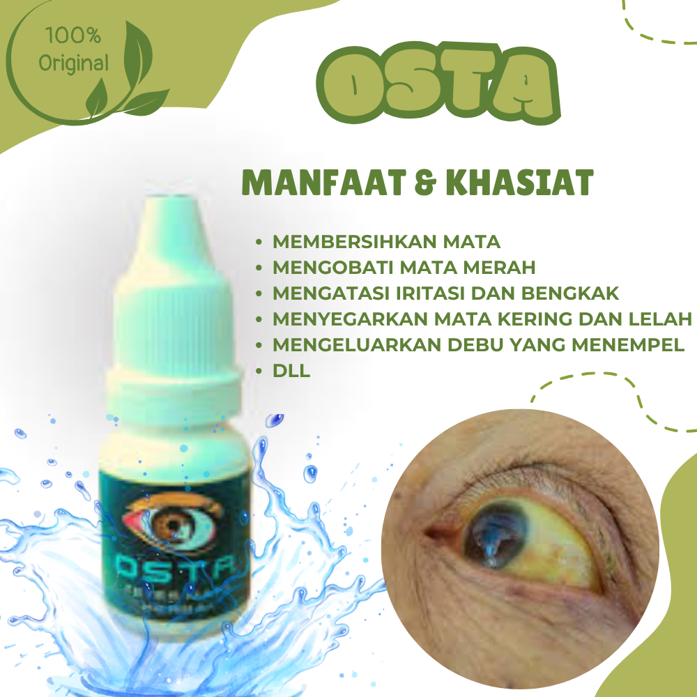 OSTA Obat Herbal Alami Mata Melorot, Bola Mata Kuning, Mata Juling Ampuh Tanpa Operasi