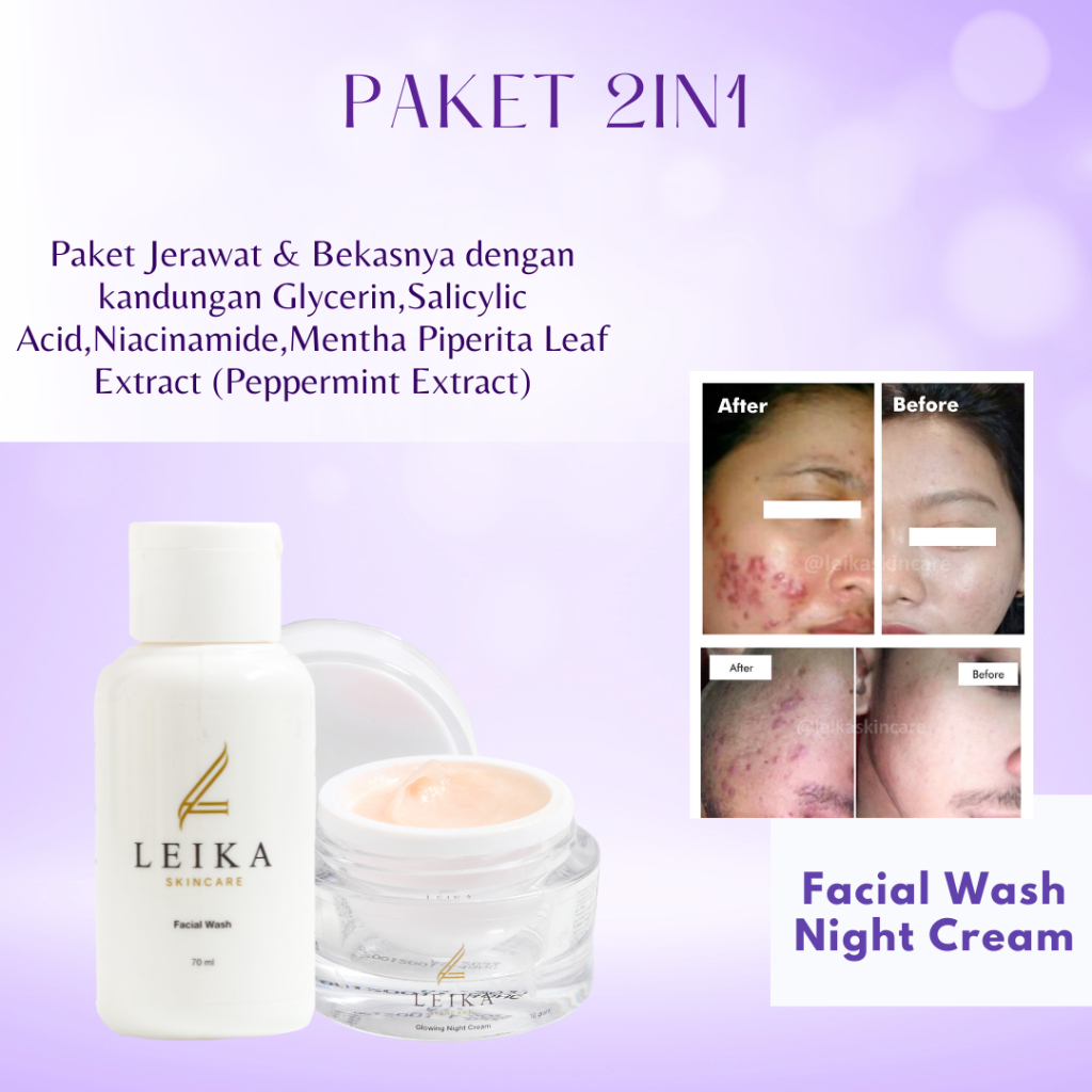 [FACIAL WASH & NIGHT CREAM] Penghilang Jerawat Dan Bekas Jerawat Bpom Penghilang Jerawat Dan Bruntus