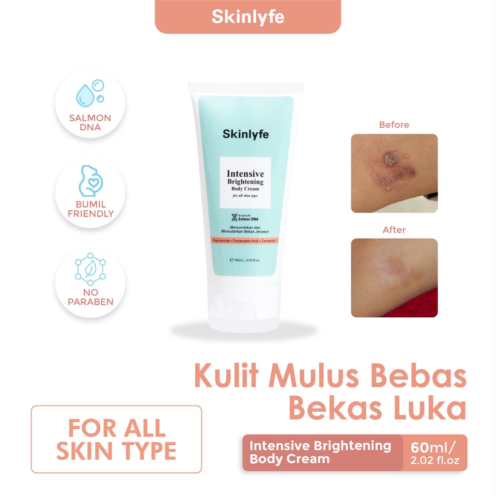 Skinlyfe -  Penghilang Bekas Luka Hitam Koreng Salep Bekas Luka Menghilangkan Bekas Luka dan Koreng