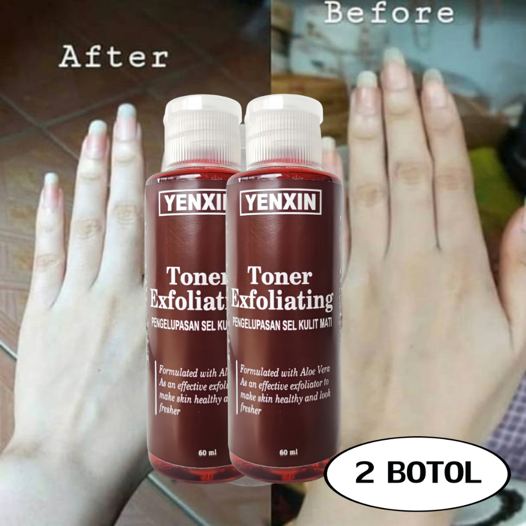 2 BOTOL TONER STRONG PENGELUPASAN TONER CEPAT PUTIH TONER EXFOLIATING YENXIN TONER KELUPAS WAJAH TON