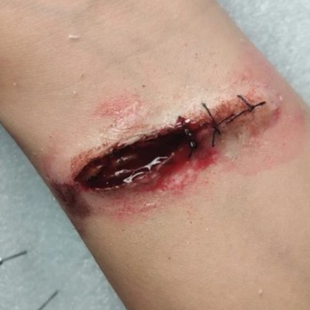 SILIKON PROSTETIK LUKA TERBUKA PALSU | SILICONE PROSTHETIC HALF STITCHES | LUKA JAHIT PALSU | SFX MA