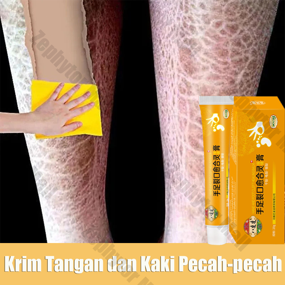 Cream Kaki Pecah Dan Kering Cream Tangan Keriput Dan Kasar Kering Perawatan Kaki Pecah Dan Kering Pe