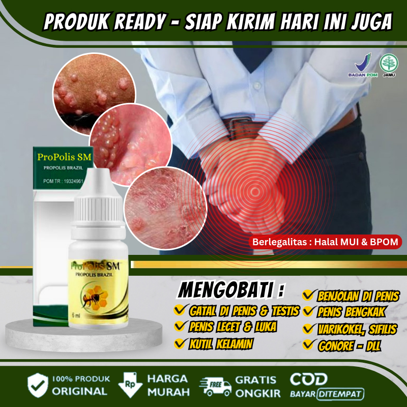 Salep Penis Gatal, Penghilang Gatal Kemaluan Pria, Obat Oles Pengering Kulit Lecet & Bernanah, Obat 