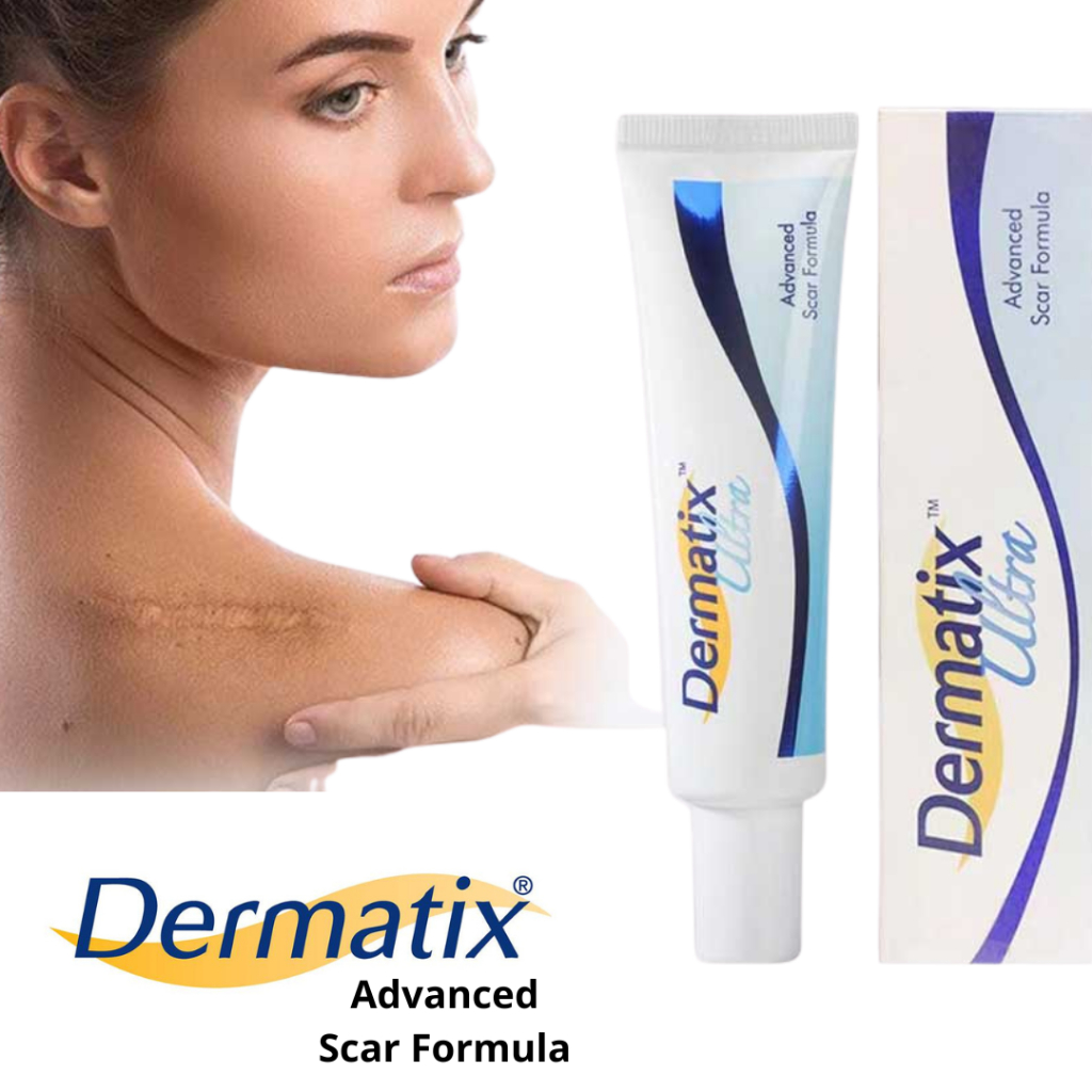 Dermatix Ultra Cream Penghilang Bekas Luka, Koreng Perawatan Bekas Luka