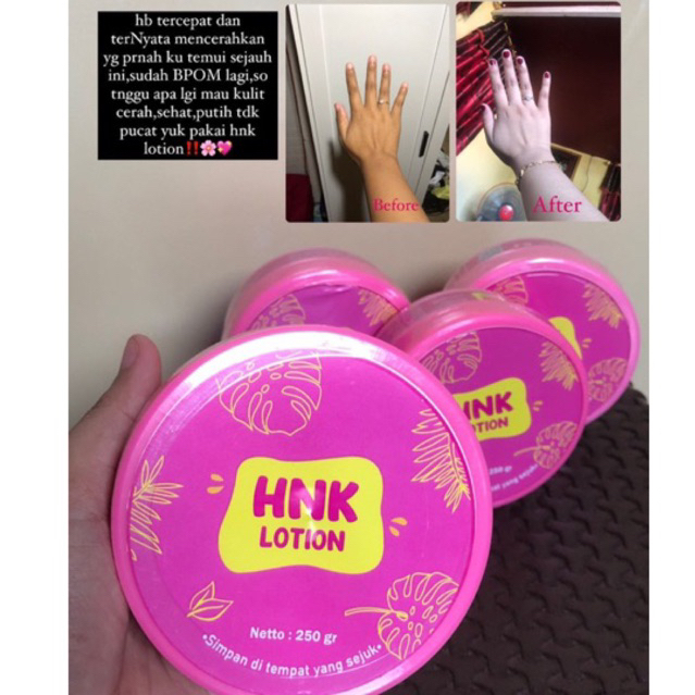 HNK Lotion HB Hnk isi 250ML 1pot