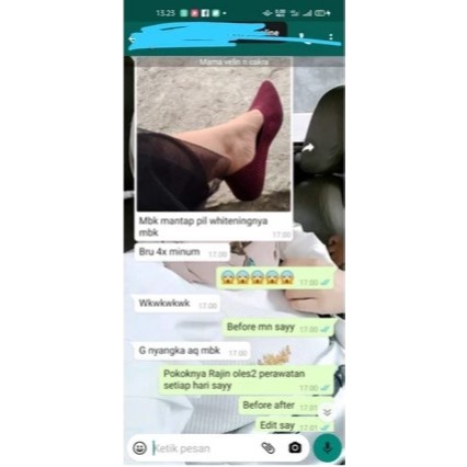 Capsule Whitening (Kapsul Pemutih) - Aybe Skincare