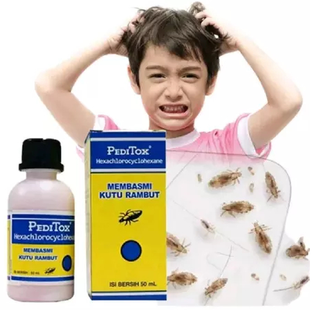 Peditox - Obat Kutu Rambut