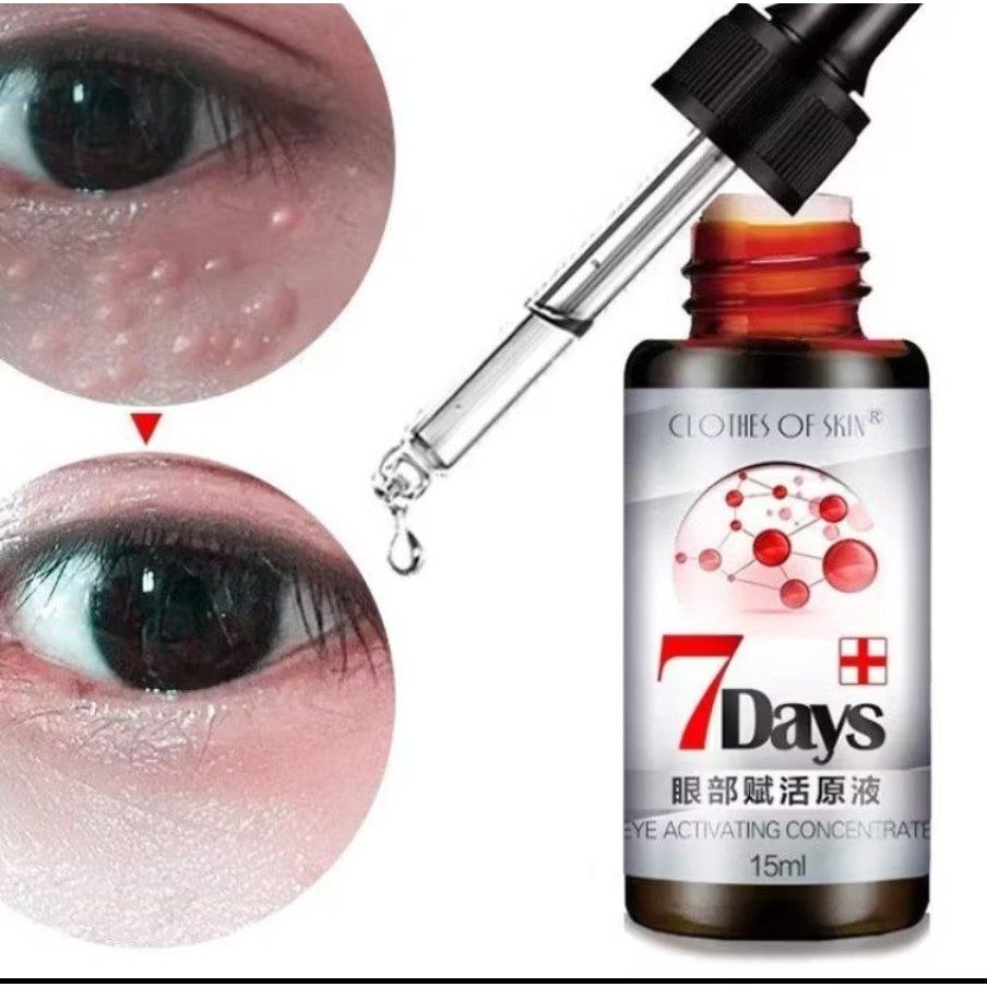 Milia remover serum / serum penghilang milia 7 hari / 7 days milia remover