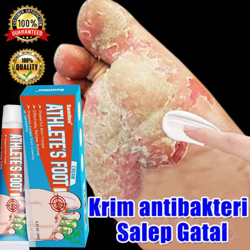 obat kaki rayapan Obat Kaki Pecah 20g Obat Telapak Kaki Rayapan obat jamur kaki Krim Pengelupas Kuli