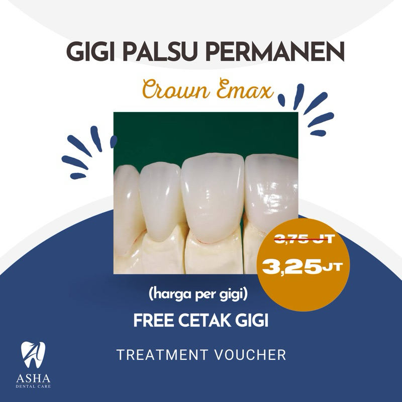 Gigi Palsu Permanen Emax