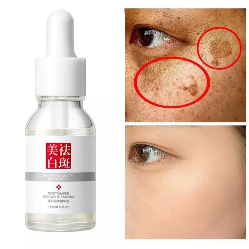 serum fuyan memutihkan dan menghilangkan flek hitam
