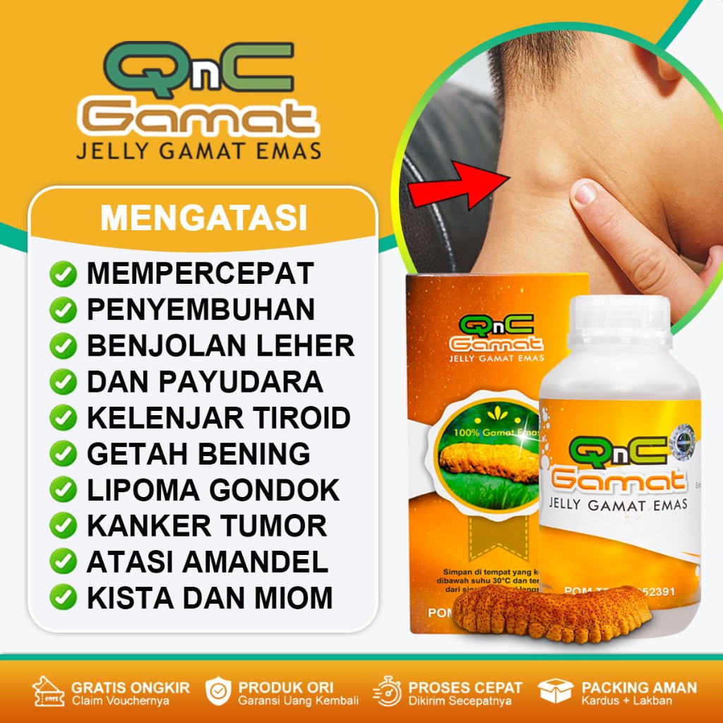 Obat Kelenjar Getah Bening Oles Benjolan Bengkak Di Tubuh Penghancur Benjolan Uci Uci Kanker Tumor K